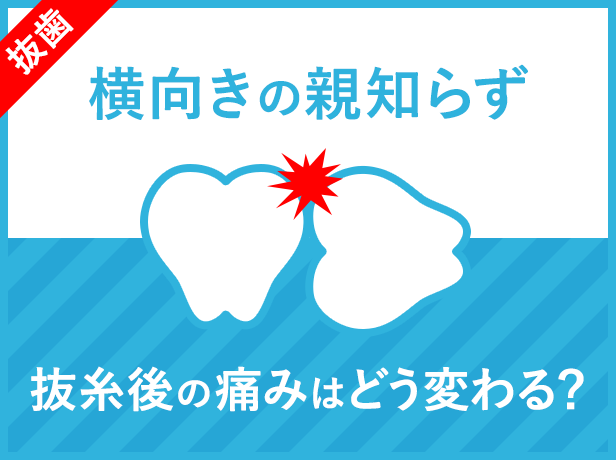 【横向きの親知らず】抜糸後の痛みはどう変わる？抜歯後7日目〜14日目の痛みの経過まとめ