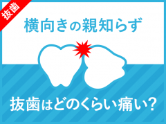 横向き親知らずの抜歯