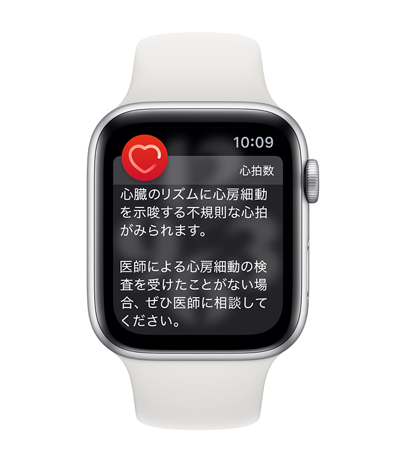 Apple Watch 不規則な心拍の通知機能