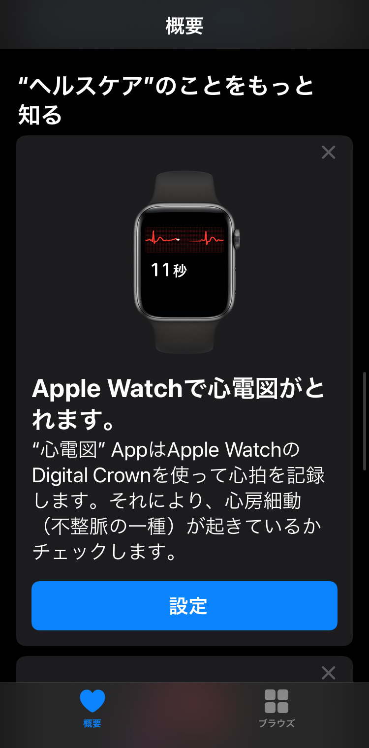 Apple Watch　心電図アプリケーションで心電図を記録する