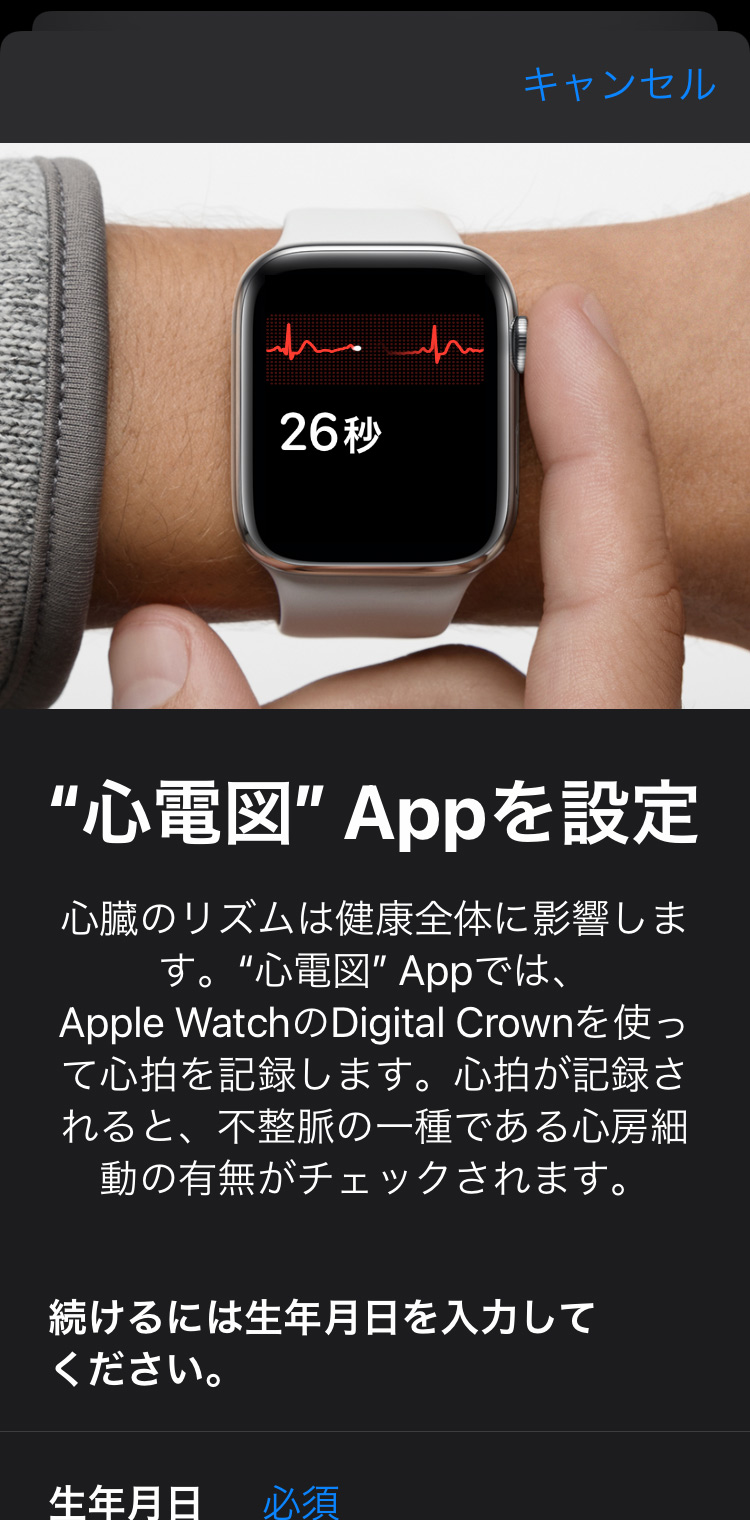 Apple Watch　心電図アプリケーションで心電図を記録する