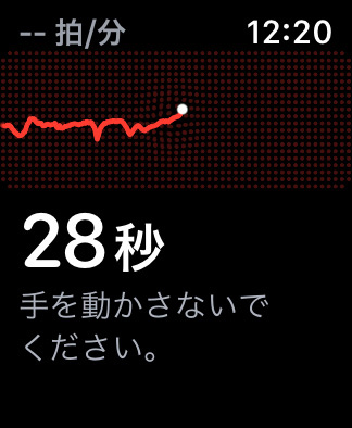 Apple Watch　心電図アプリケーションで心電図を記録する