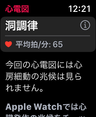 Apple Watch　心電図アプリケーションで心電図を記録する