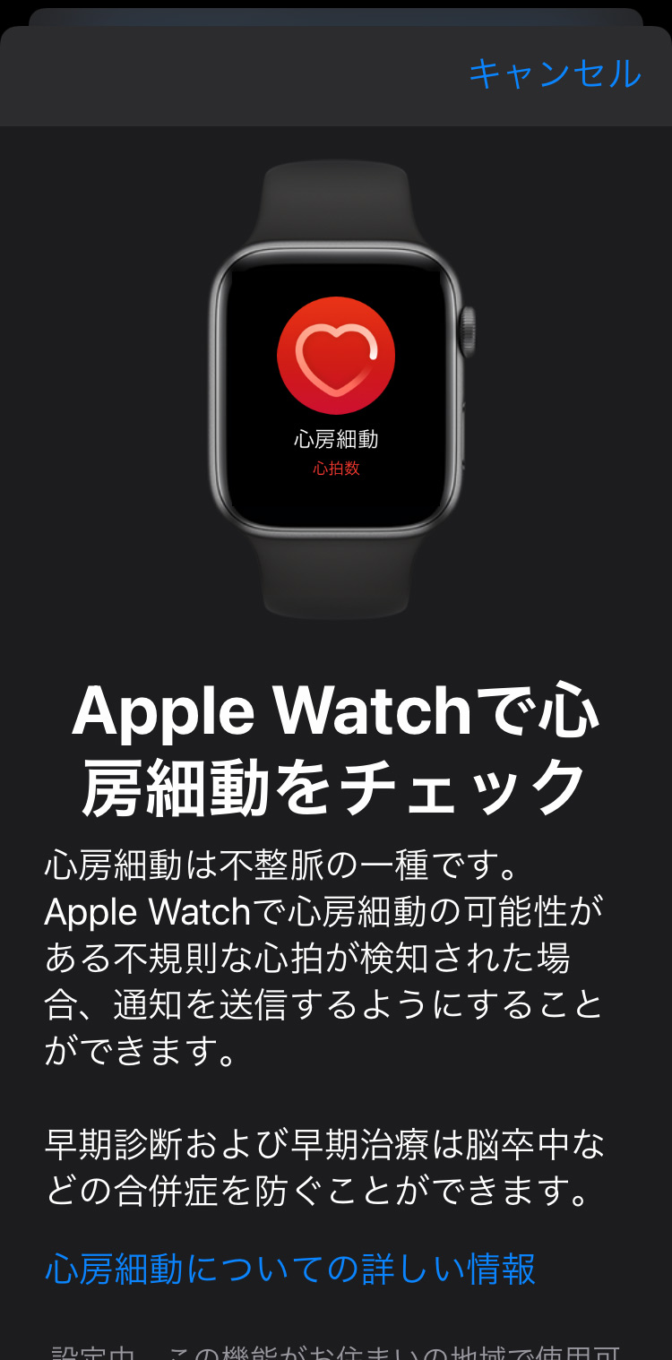 Apple Watch 不規則な心拍の通知機能を設定する