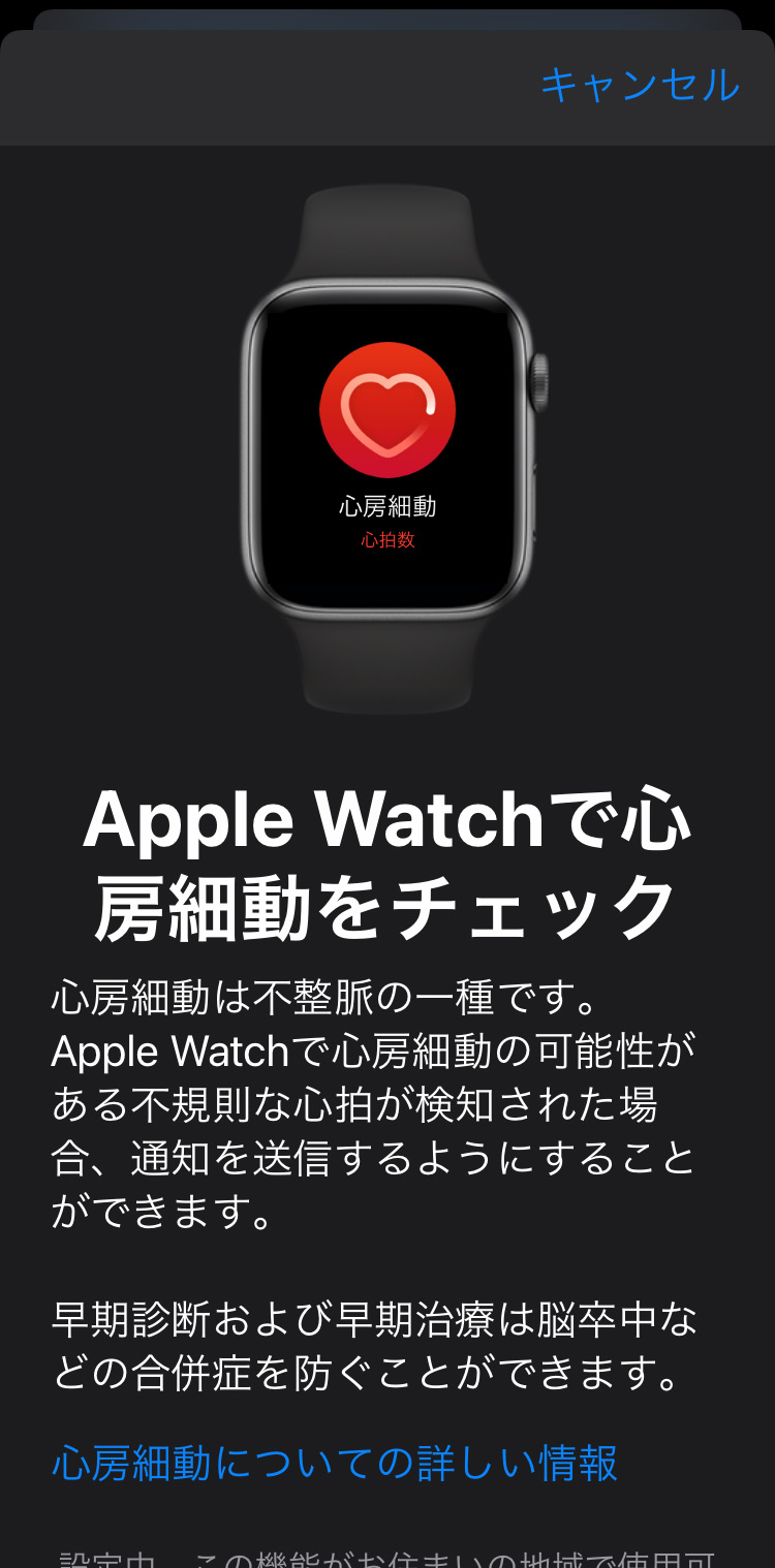 Apple Watch 不規則な心拍の通知機能を設定する