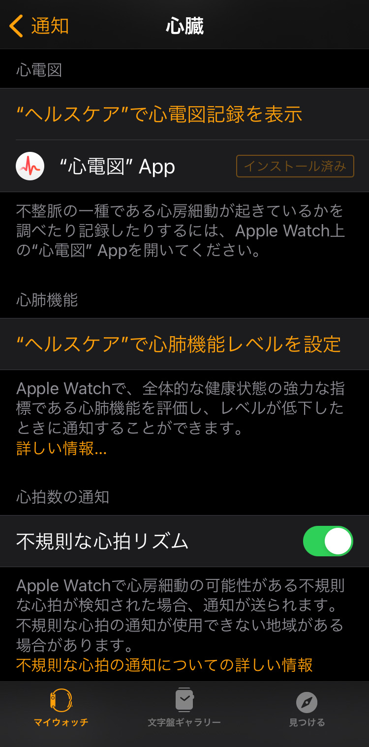 Apple Watch 不規則な心拍の通知機能を設定する