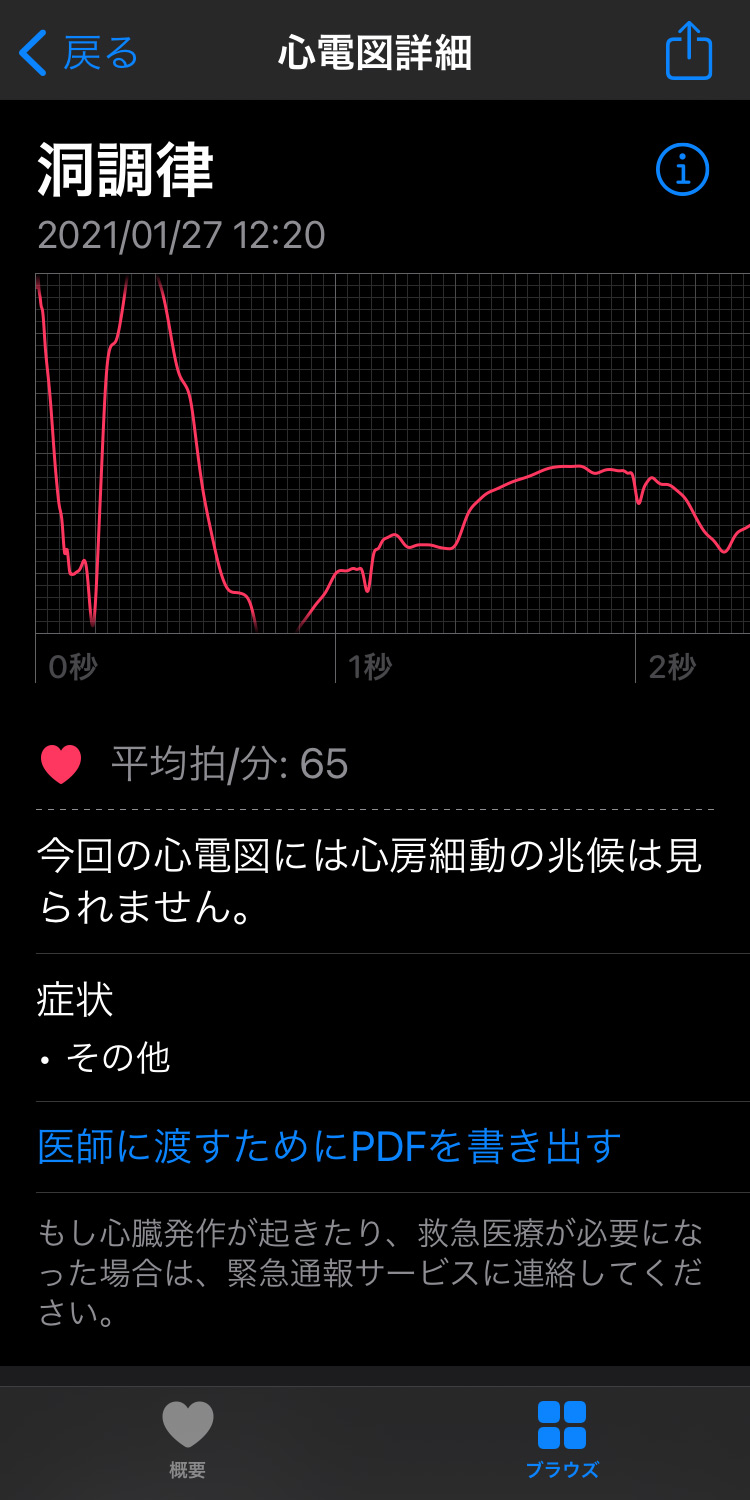 Apple Watch/iPhone 心電図のデータをPDFで出力する